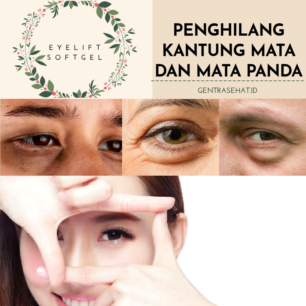 Penghilang Kantung Mata dan Mata Panda Ampuh [ Paket Platinum ]