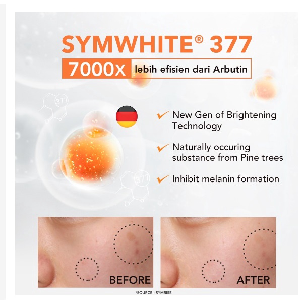 YOU ( Y.O.U ) Radiance Up!  Antioxidant  Serum SymWhite 377+ Korean Camellia Extract