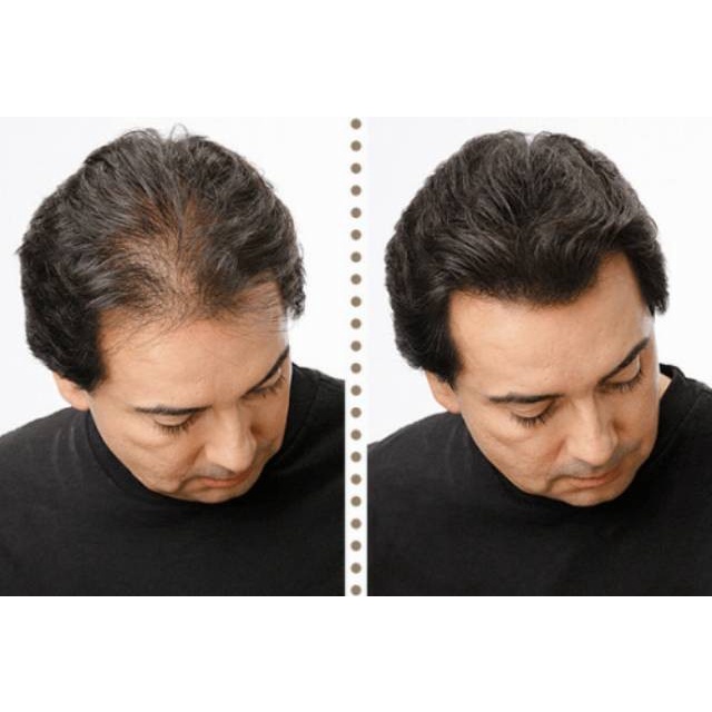 TOPPIK PENEBAL RAMBUT TIPIS HAIR BUILDING FIBER 27.5gr PELEBAT RAMBUT