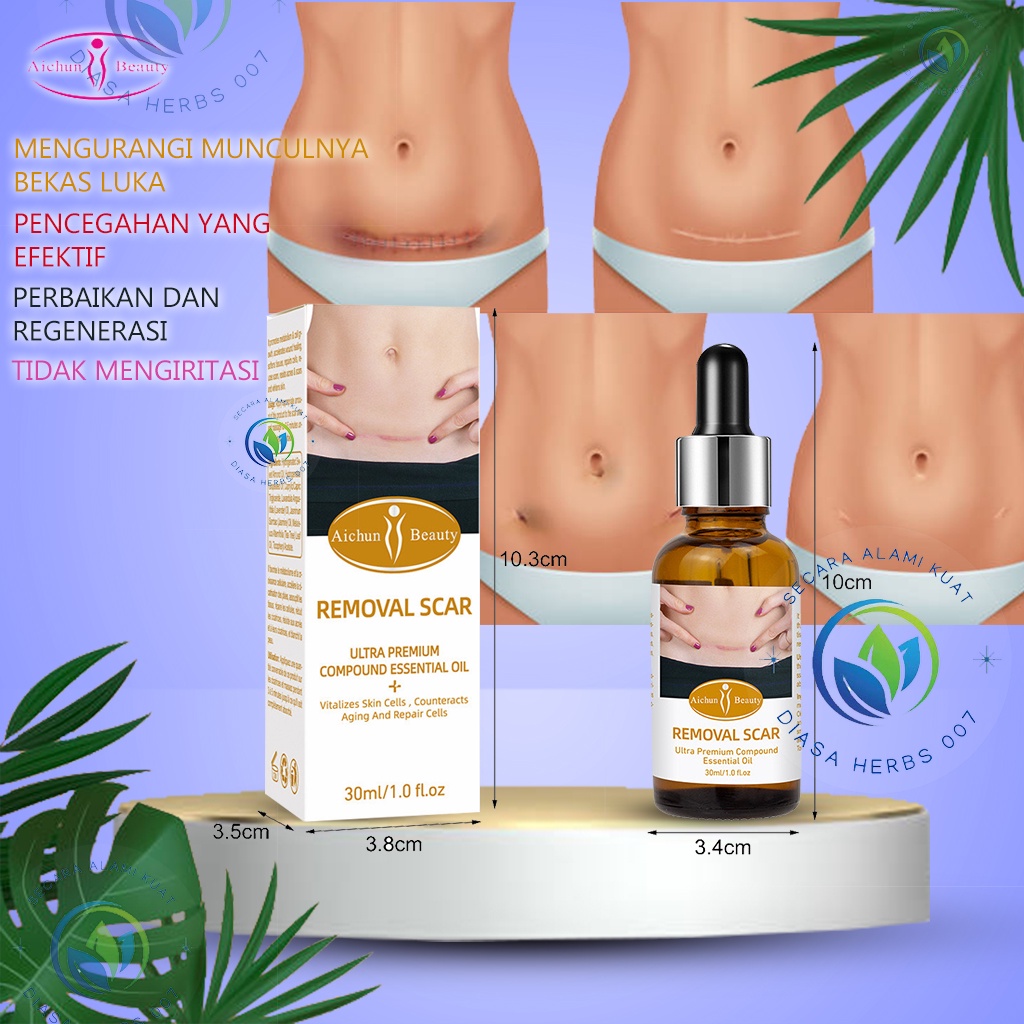 Aichun Herbs Remove Scar Pregnancy penghilang bekas luka pasca operasi