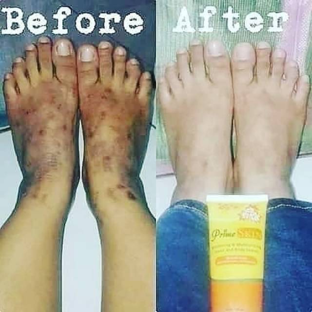 Prime skin handbody lotion (menghilangkan bekas luka & memutihkan)