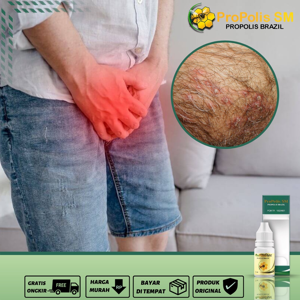 Obat Gatal Kelamin Pria Dan Wanita, Obat Gatal Di Kemaluan, Obat Gatal Di Area Kelamin, Obat Pembunu