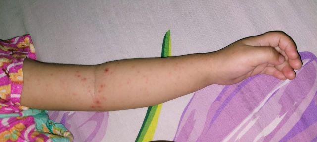 Kotak Makan Plastik Sayur | Kotak Penyimpan Makanan Transparan 3000ml