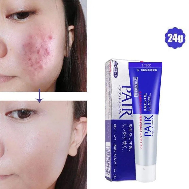 LION PAIR Acne Cream W24g  Antibacterial Acne Face Krim W Anti Jerawat Original Jepang