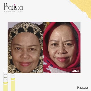 Pratista - [Bundling] Calming Spray &amp; Advance Glow Night Cream