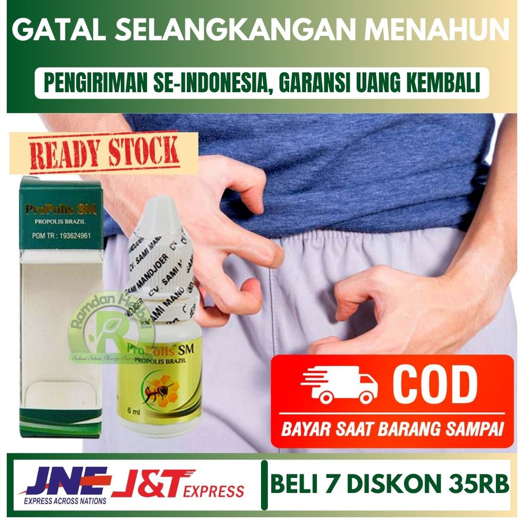 Obat Gatal Selangkangan Menahun Eksim Menahun Jamur Kulit Menahun Propolis SM Sudah BPOM