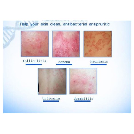 Zudaifu Salep Gatal Gatel Alergi Kulit Eksim Kurap Jamur Original-3