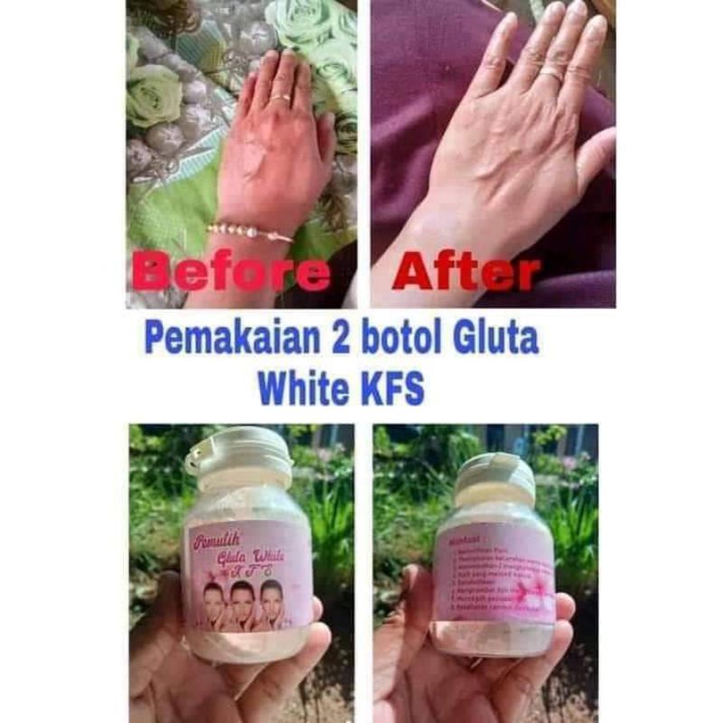 susu gluta kfs