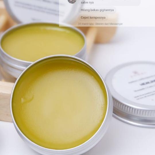 ♙ Calendula Healing Salve for eczema and dry skin| Ruam Pipi Bayi | Kulit Sensitif | Salep eksim ➽