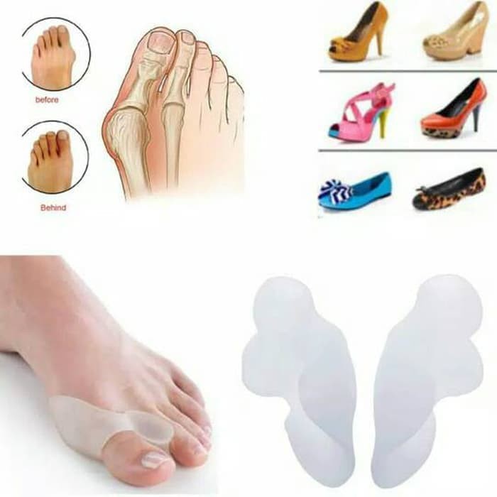 ALAT TERAPI KAKI JEMPOL KAKI HALLUX VALGUS BUNION PEMISAH KOREKTOR JARI KAKI JEMPOL