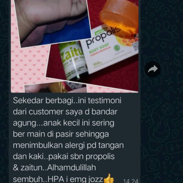 Paket Obat Gatal Alergi Anak