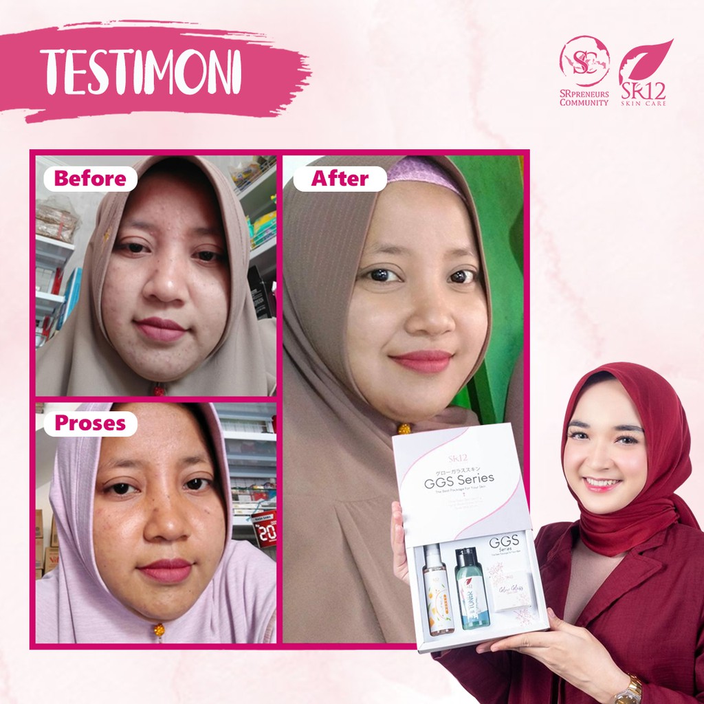 GGS SR12 / GLOW GLASS SKIN GEL / MENCERAHKAN KULIT WAJAH / MEMUDARKAN FLEK / KRIM GLOWING