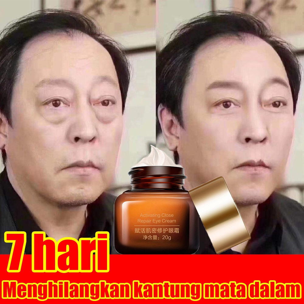 【O'RANNLE】Krim mata anti kerut Krim mata mencerahkan Mencerahkan mata panda Menghilangkan lingkaran mata hitam Krim mata anti penuaan kerutan Kolagen asam hyaluronic 30gr Untuk Kerut Wajah, Flek Hitam, Kusam, Anti Penuaan, Lingkaran Hitam, Kantong Mata