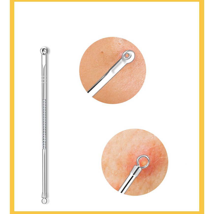HL0140 Alat Pencet Jerawat Komedo Set 4 In 1 Pinset Jerawat Pembersih Blackhead