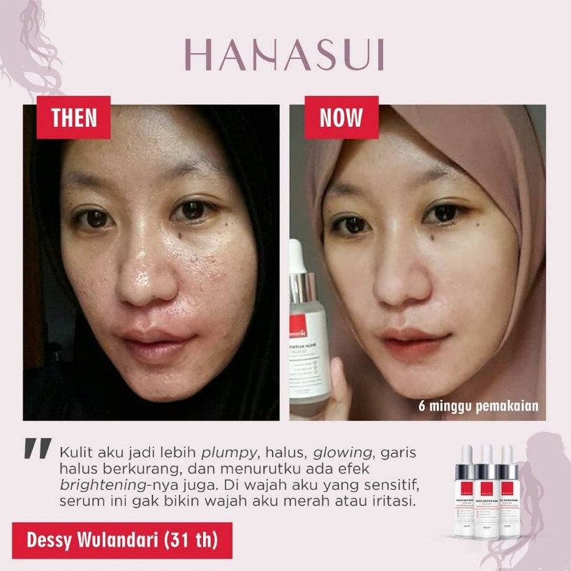 ⭐BAGUS⭐ HANASUI PREMIUM SERUM INTENSE TREATMENT | Bright Up / Propolis / Rich Nutrition 25ml