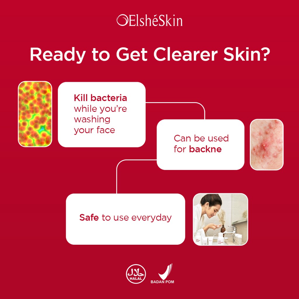 ElsheSkin Acne Cleansing Wash - 100ml Salicylic Acid (Rawat Kulit Berjerawat Tanpa Kering dan Iritasi) - Sabun Cuci Muka Jerawat