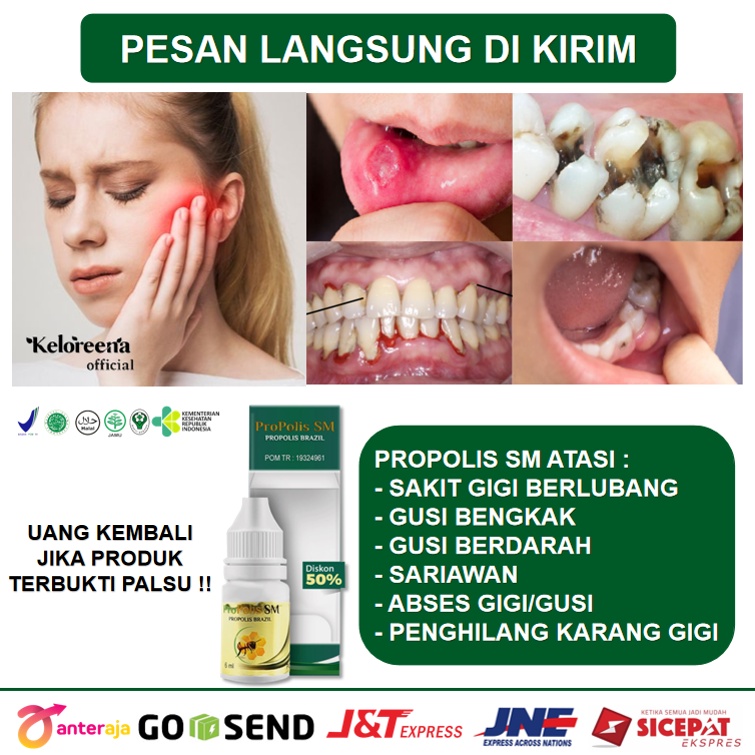 Jual Obat Polip Gigi,Polip Gusi, Polip Pulpa Gigi, Sakit Gigi,Nyeri ...