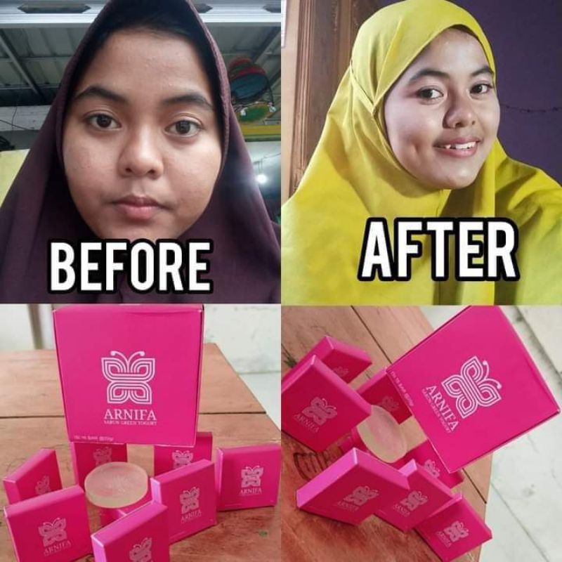 SABUN NYRTEA / SABUN ARNIFA / SABUN GLOWING / SABUN WAJAH / BPOM / 20RB