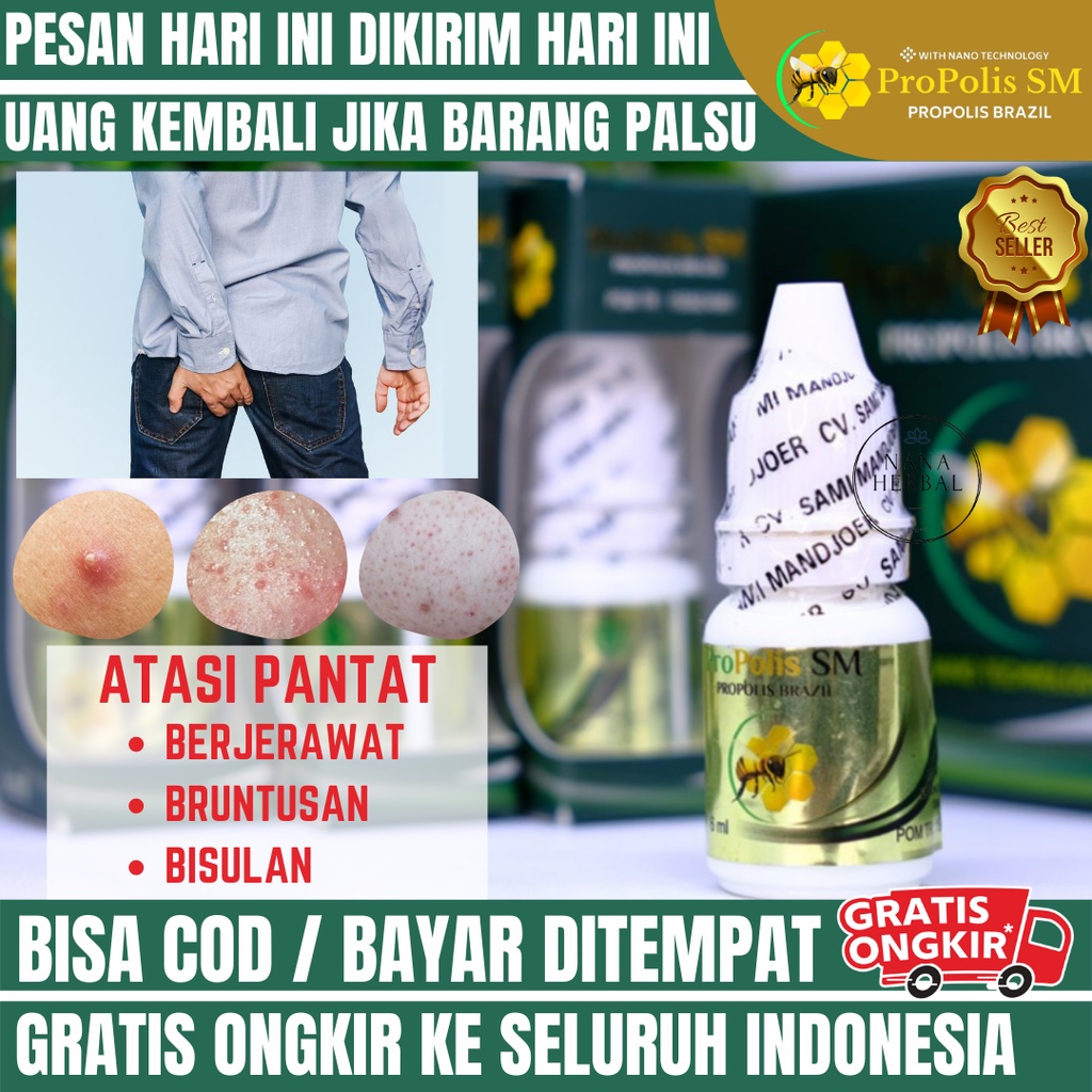 OBAT HERBAL PROPOLIS SM - Obat Jerawat di Pantat - Obat Bruntusan di Pantat - Obat Penghilang Bekas 