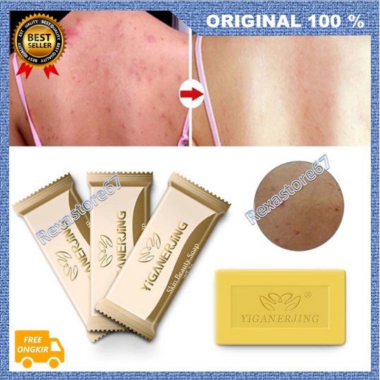 [BISA COD] Yiganerjing Sabun Anti Jamur Eksim Penghilang Jenis Penyakit Kulit Ampuh 100% Original