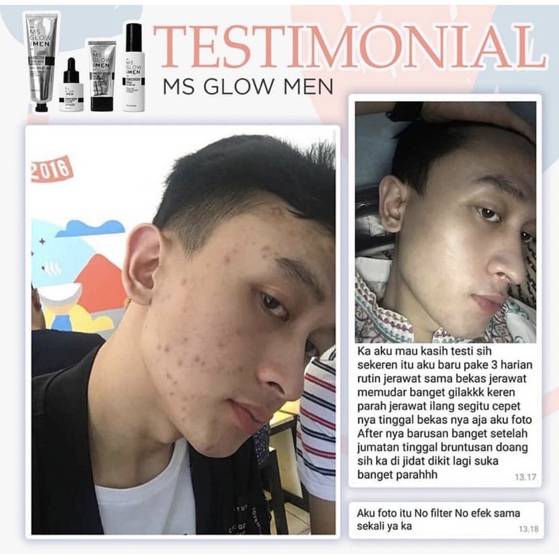 MS GLOW FOR MEN PAKET WAJAH