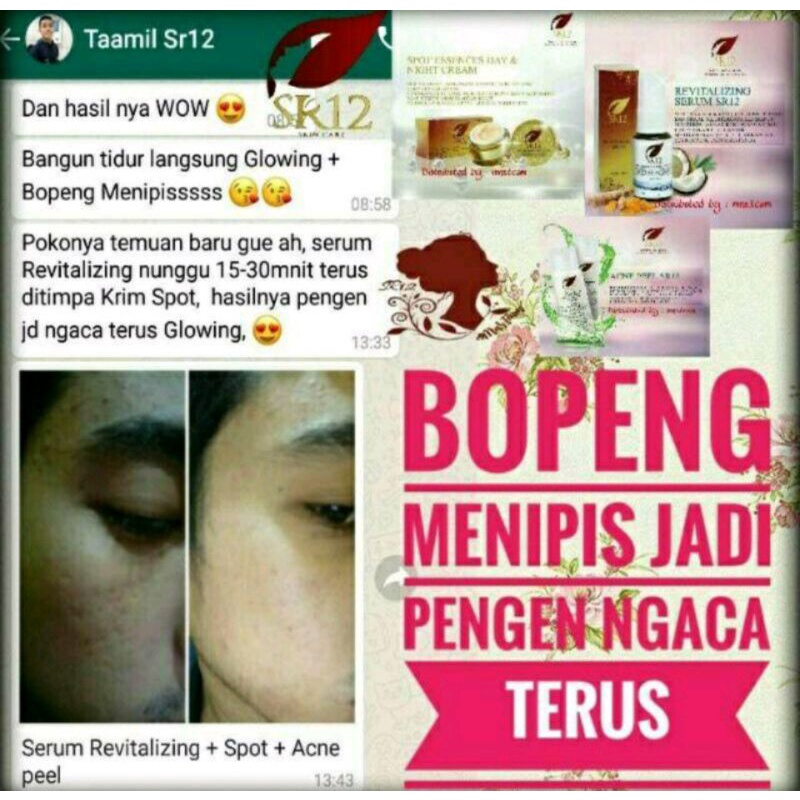 SERUM REVITALIZING SR12 / SERUM WAJAH /SERUM MATA PANDA SKINCARE BPOM /SERUM PENGHILANG BOPENG / SERUM ANTIAGING /SERUM MENGECILKAN PORI-PORI