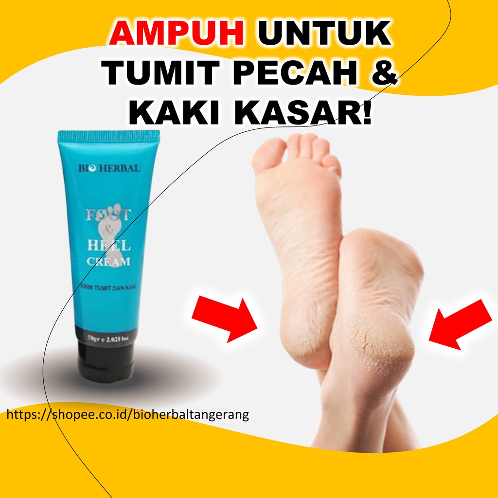 Obat Kaki Pecah Dan Kering Pecah2 Kasar Parah Yang Ampuh BPOM B10P