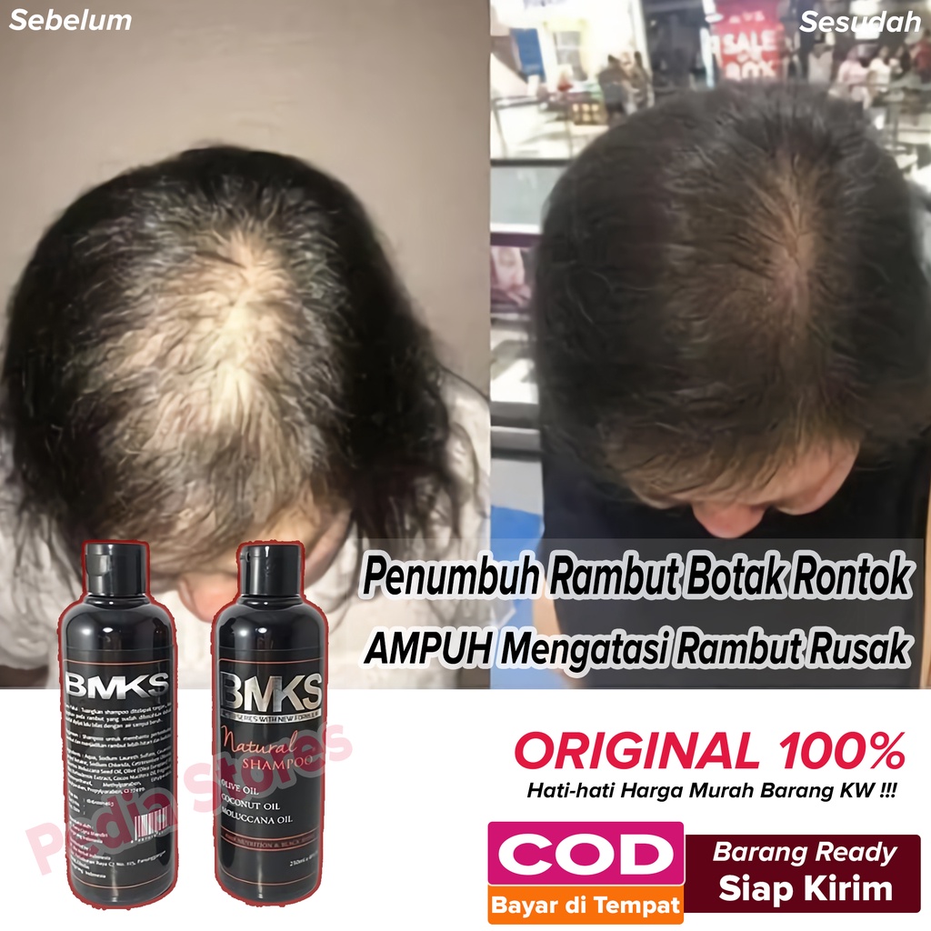Penumbuh Rambut Botak Penyubur Rontok Untuk Wanita Pria Alami Cepat Shampo BMKS Natural 250ml