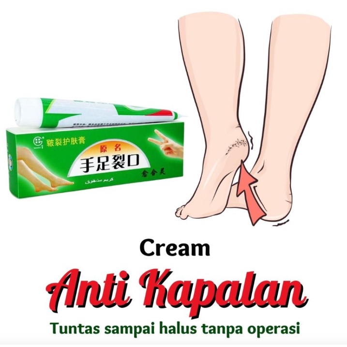 Obat Krim Kaki Pecah Pecah Tangan Tumit Ampuh Kering Tebal Mengelupas Cream Salep Mulus