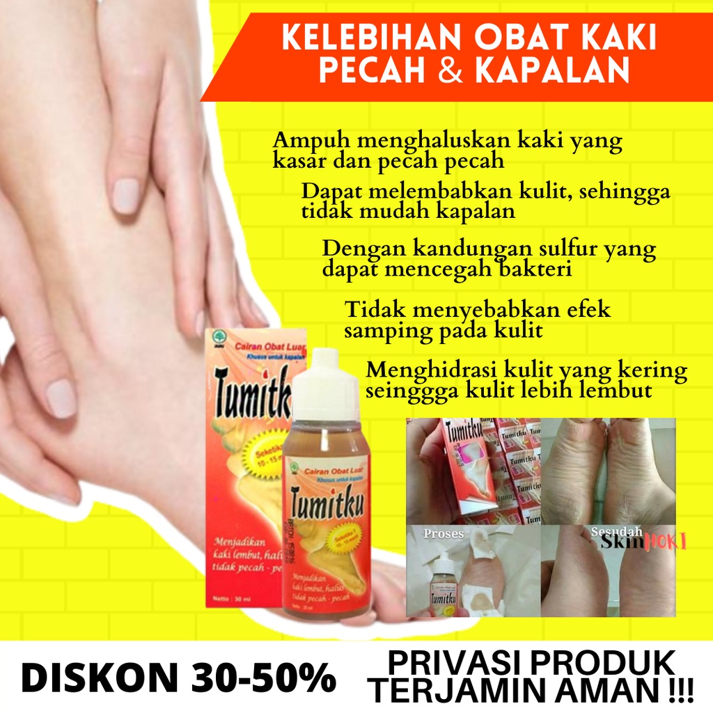 OBAT HERBAL TUMIT PECAH PECAH PENGHALUS TUMIT TUMITKU 60ML PENGHILANG KAPALAN ORIGINAL BPOM