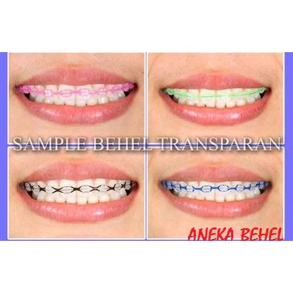 Transhu Harga Behel  Keramik  Fashion