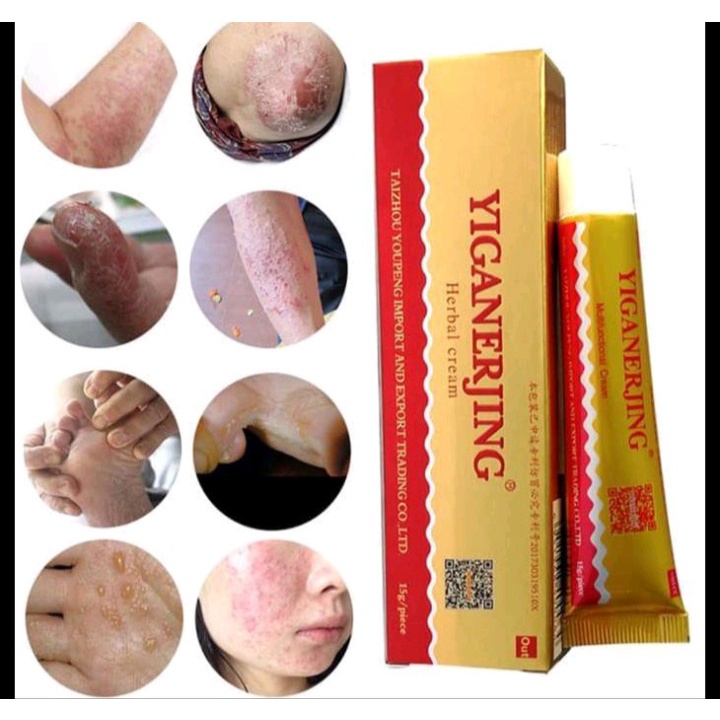 [BISA COD] Salep Yiganerjing | Cream Yiganerjing 15Gram | Salep Eksim Jamur Psoriasis Dermatitis | Salep Herbal