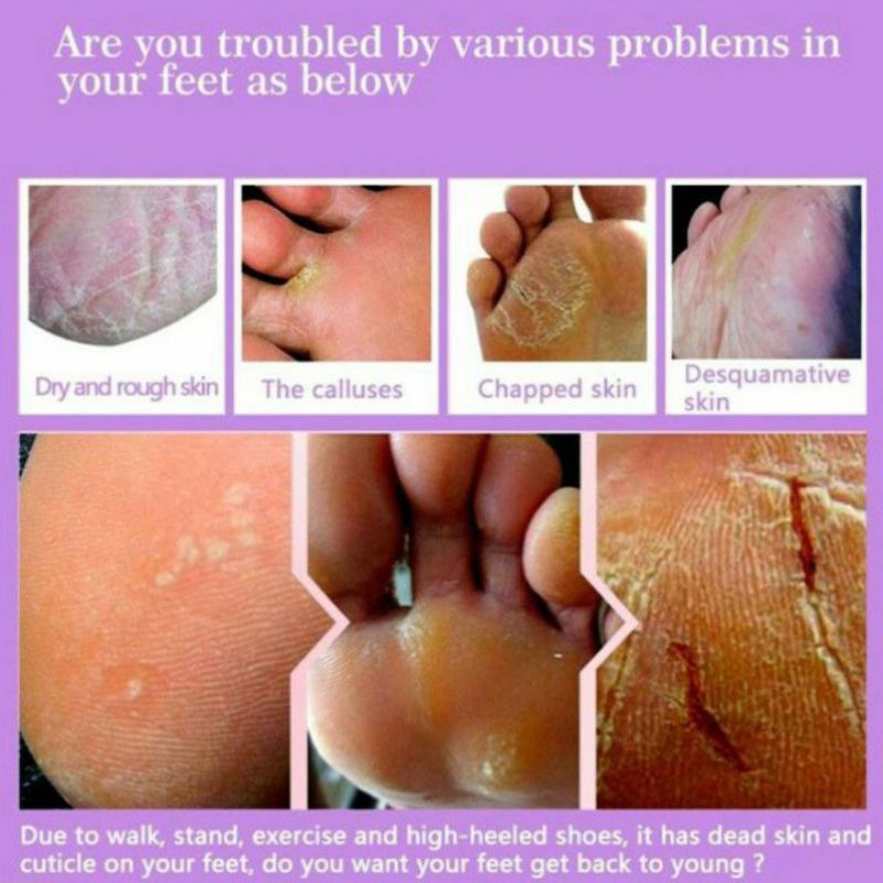 SADOER FOOT MASK Masker Kaki Foot Peeling Exfoliating Viral Terbaru