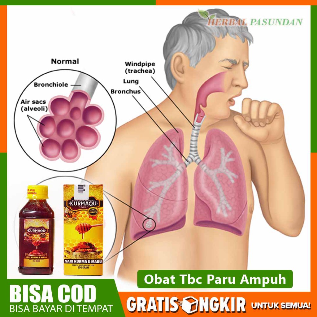 

obat herbal tbc paru paru kronis, berkeringat dingin, lemas 100% original qurmaku sari kurma