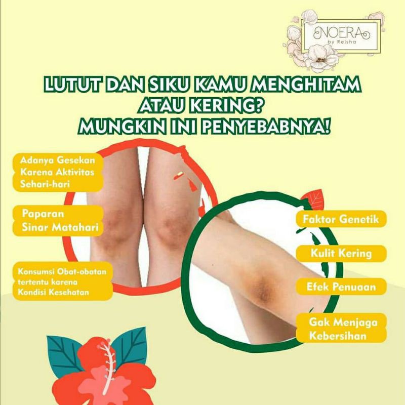 NOERA SKIN LIGHTENING CREAM - Armpit Cream Pemutih Lipatan Pemutih Ketiak Pemutih Sel