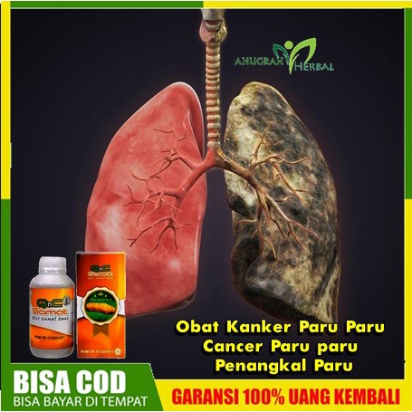 Obat Kanker Paru Paru Cancer Paru paru Penangkal Paru Terkena Kanker Herbal QnC Jelly Gamat Original