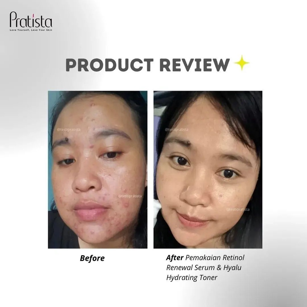 Pratista Paket BEST COMBO Hyalu Hydrating Toner + Retinol Renewal Serum 100% ORI