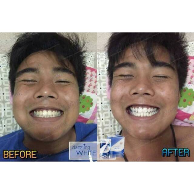 PEMUTIH GIGI DAZZLING WHITE PEN USA