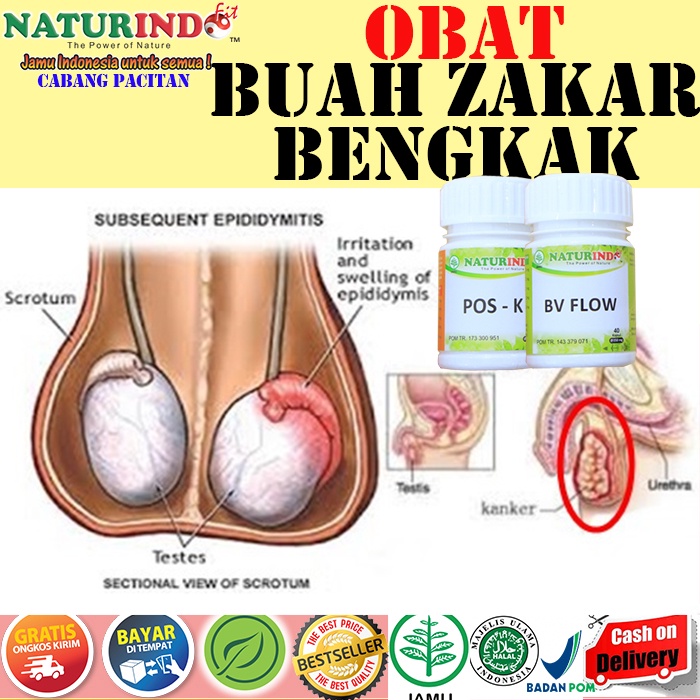 OBAT HERBAL BUAH ZAKAR BENGKAK MANDUL NYERI TESTIS VARIKOKEL BV FLOW POS K NATURINDO COD BPOM