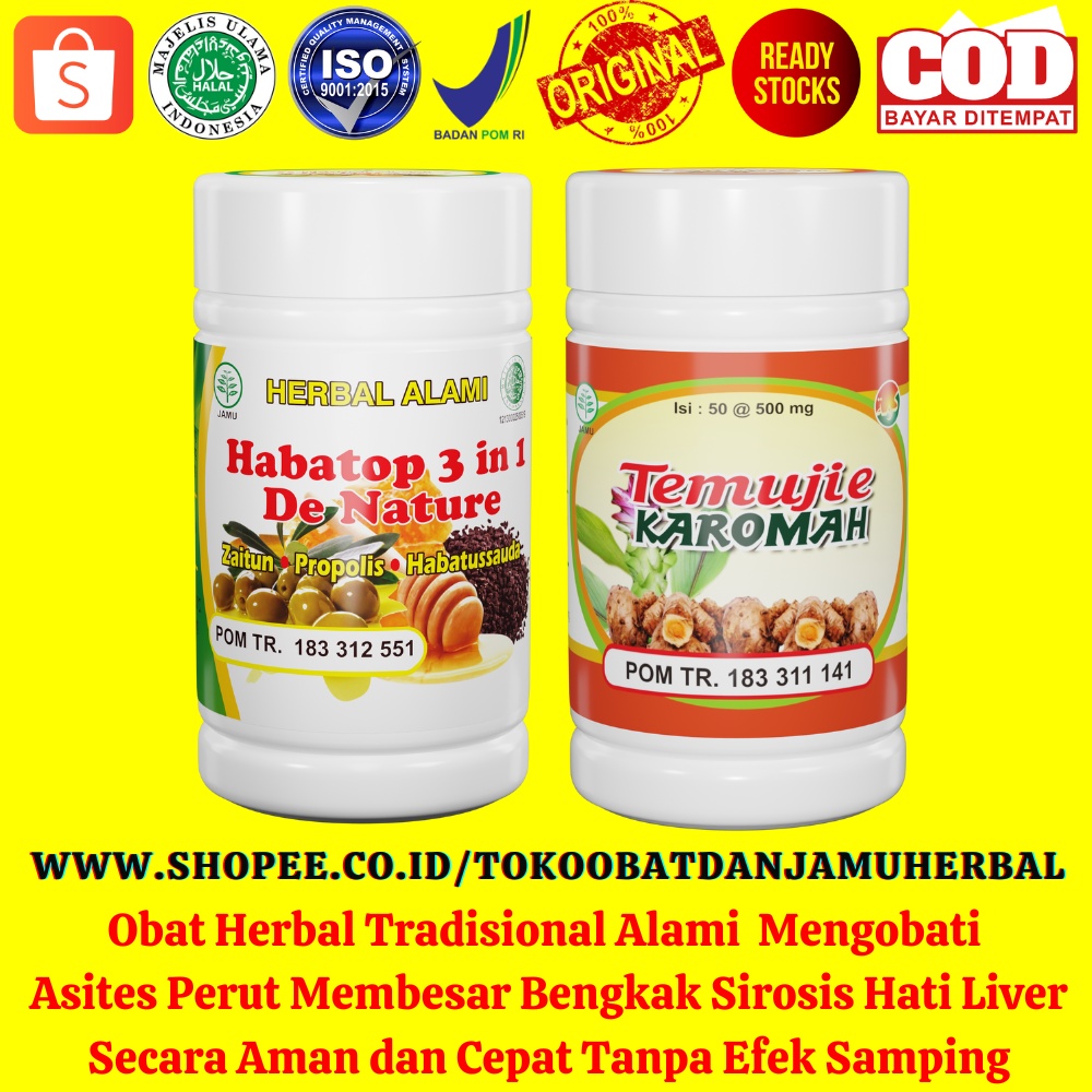 Obat Herbal Mengobati Asites Perut Membesar Bengkak Sirosis Hati Liver