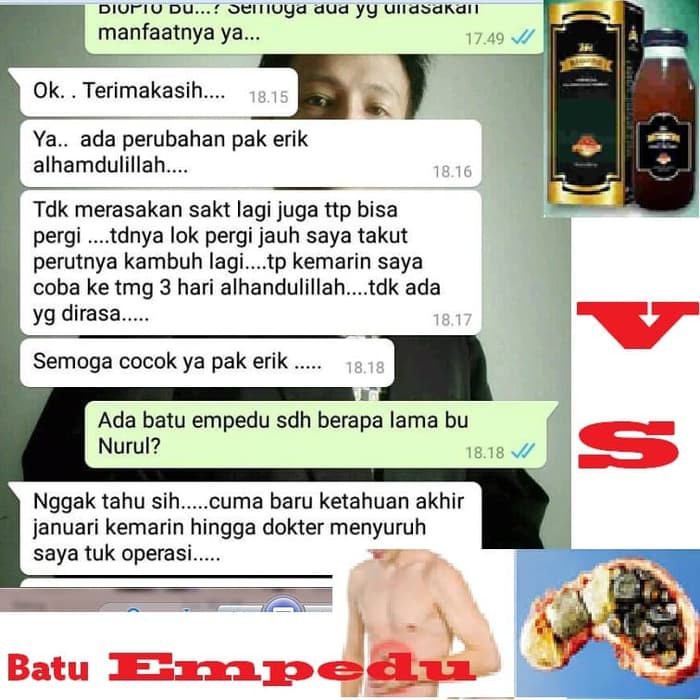 Jual m Biopro | M Biopro Untuk Batu Empedu | Fungsi M Biopro | M Biopro Untuk Gagal Ginjal