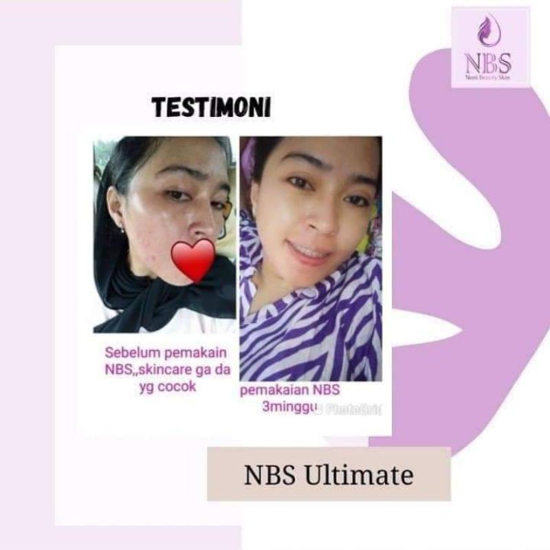 Nbs Skincare Original free lipstik