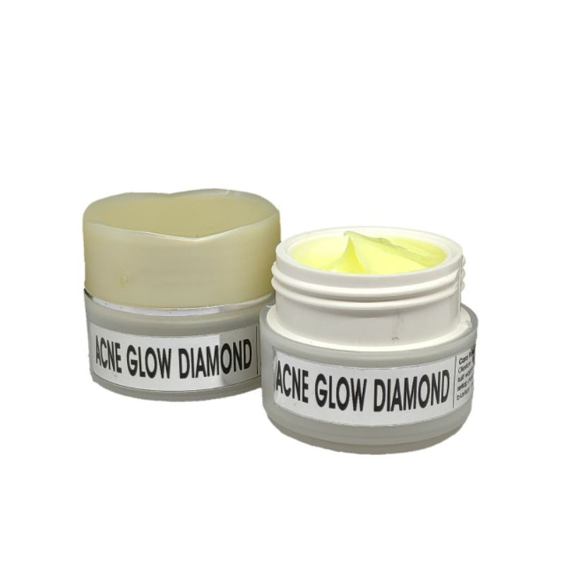 BEST SELLER! Cream Malam Acne Glow Diamond / Acne Glow Forte