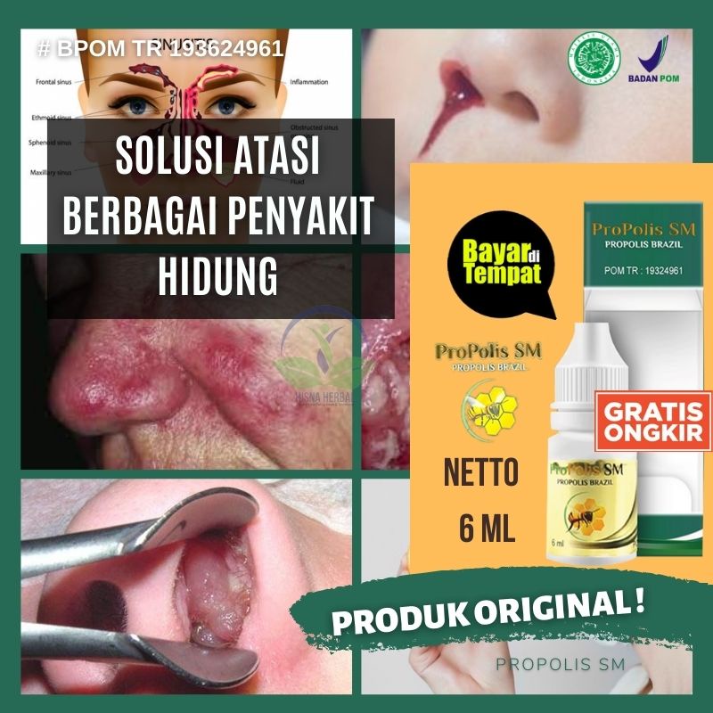 Obat Tetes Hidung Bau Busuk, Penghilang Hidung Bau Telur Busuk, Obat Hidung Bau Aneh, Obat Menghilan