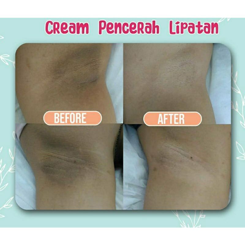 Cream Pencerah Lipatan - pemutih ketiak / selangkangan - krim slengky [ CREAM LIPATAN MURAH ]