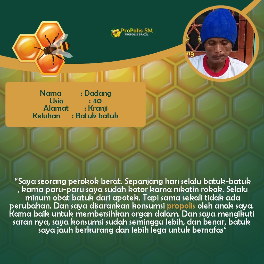 Propolis Sm Propolis Brazil Asli Obat Batuk Berdahak Kering Berdarah Asma Menahun Rajen Shopee Indonesia