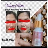 serum propolis
