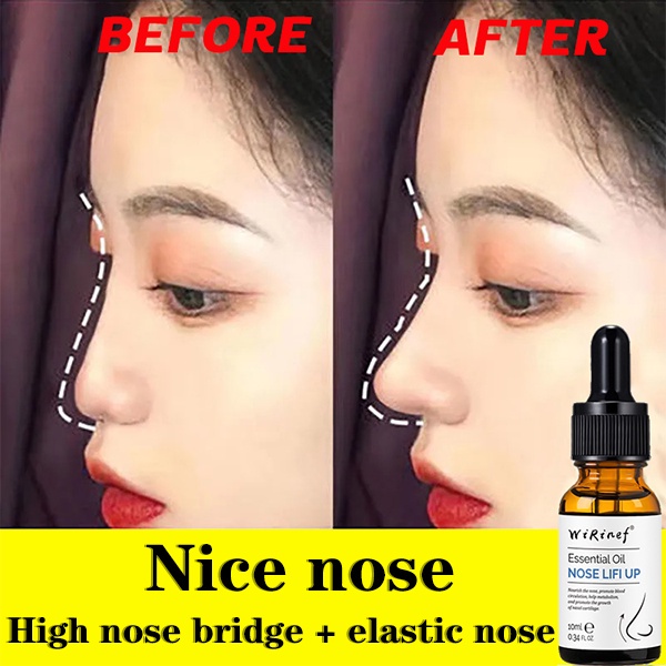 Minyak esensial hidung Minyak esensial pelembab Pijat minyak esensial untuk memperbaiki hidung