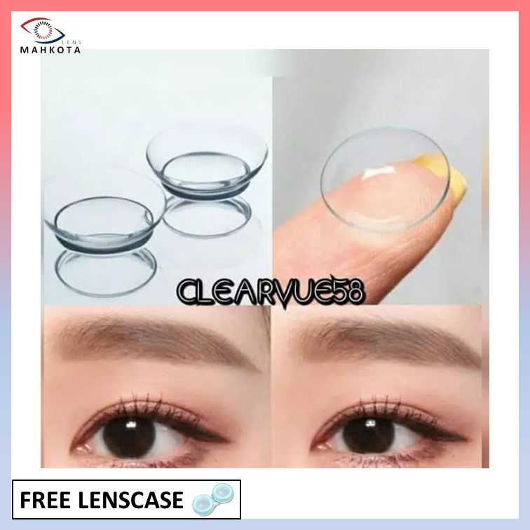 SOFTLENS BENING X2 EXO CLEAR MINUS (-0.50 sd -10.00) FREE LENSCASE By EXOTICON / EXOCLEAR Soflens