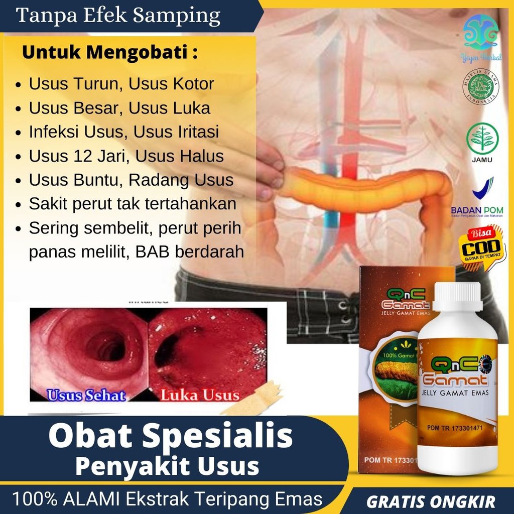 Obat Usus Buntu Radang Usus Turun Usus Kotor Usus Besar Usus Luka infeksi Usus iritasi 100% ORIGINAL